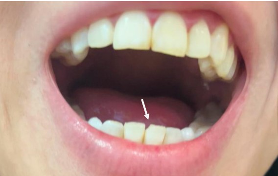 Dentiste Boulogne Dr. Marie-Paule Slama