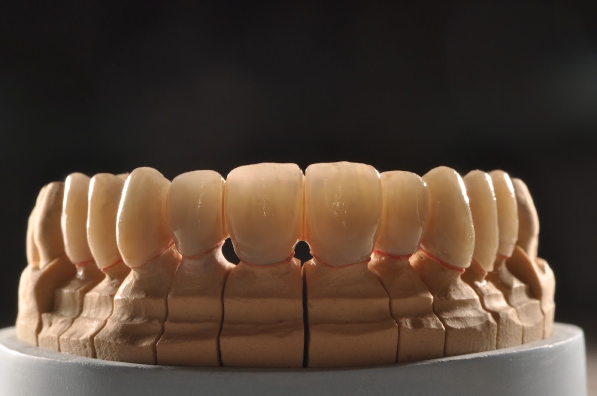 Dentiste Bordeaux - KAWCHAGIE Sarah - Esthétique et prothèses