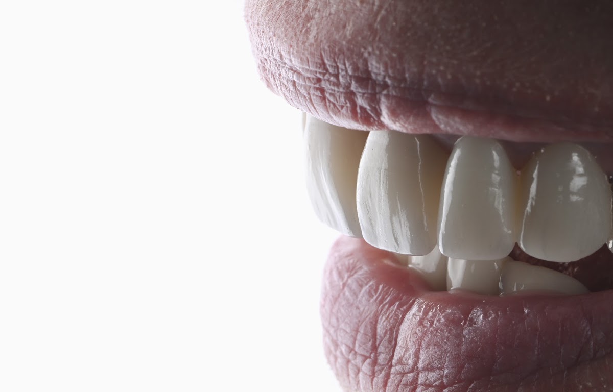 Dr Bourdin Clément - Chirurgien Dentiste