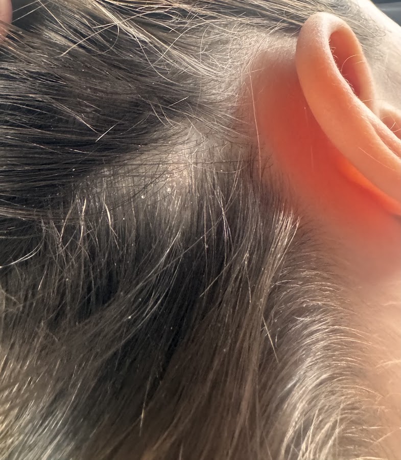 Diagonal Coiffure