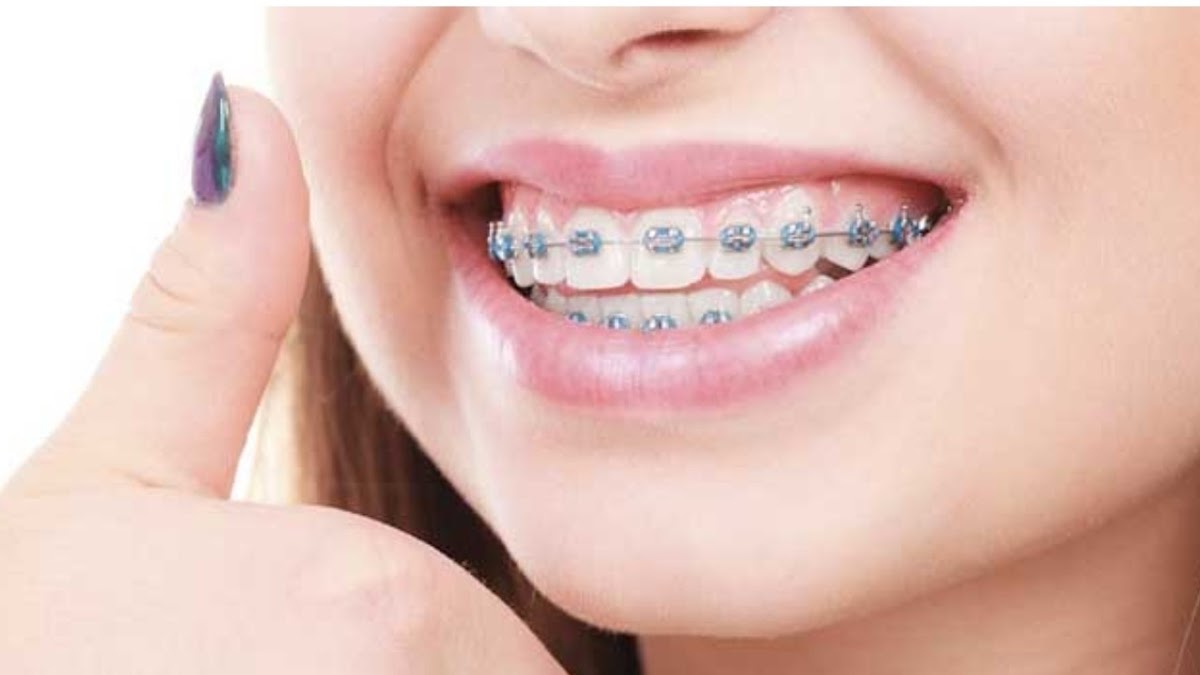 Dr David Danan . Chirurgien Dentiste , exercice limité à L’Orthodontie