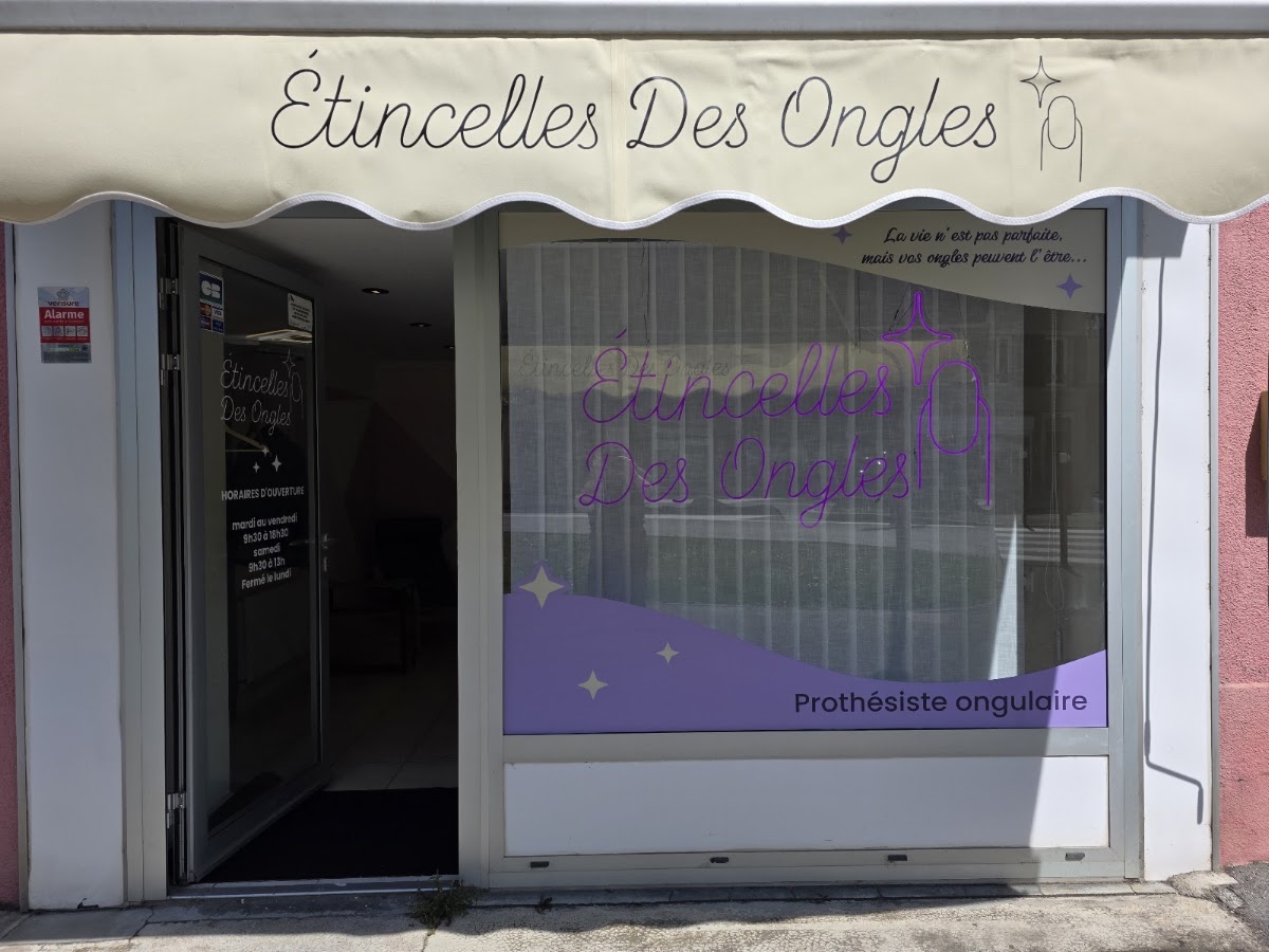 Etincelles Des Ongles